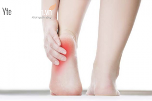Cách giảm đau gót chân sau khi chạy bộ
